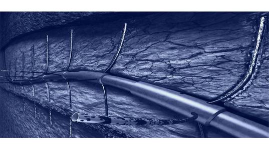 Fishbones needles (Credit: Fishbones)